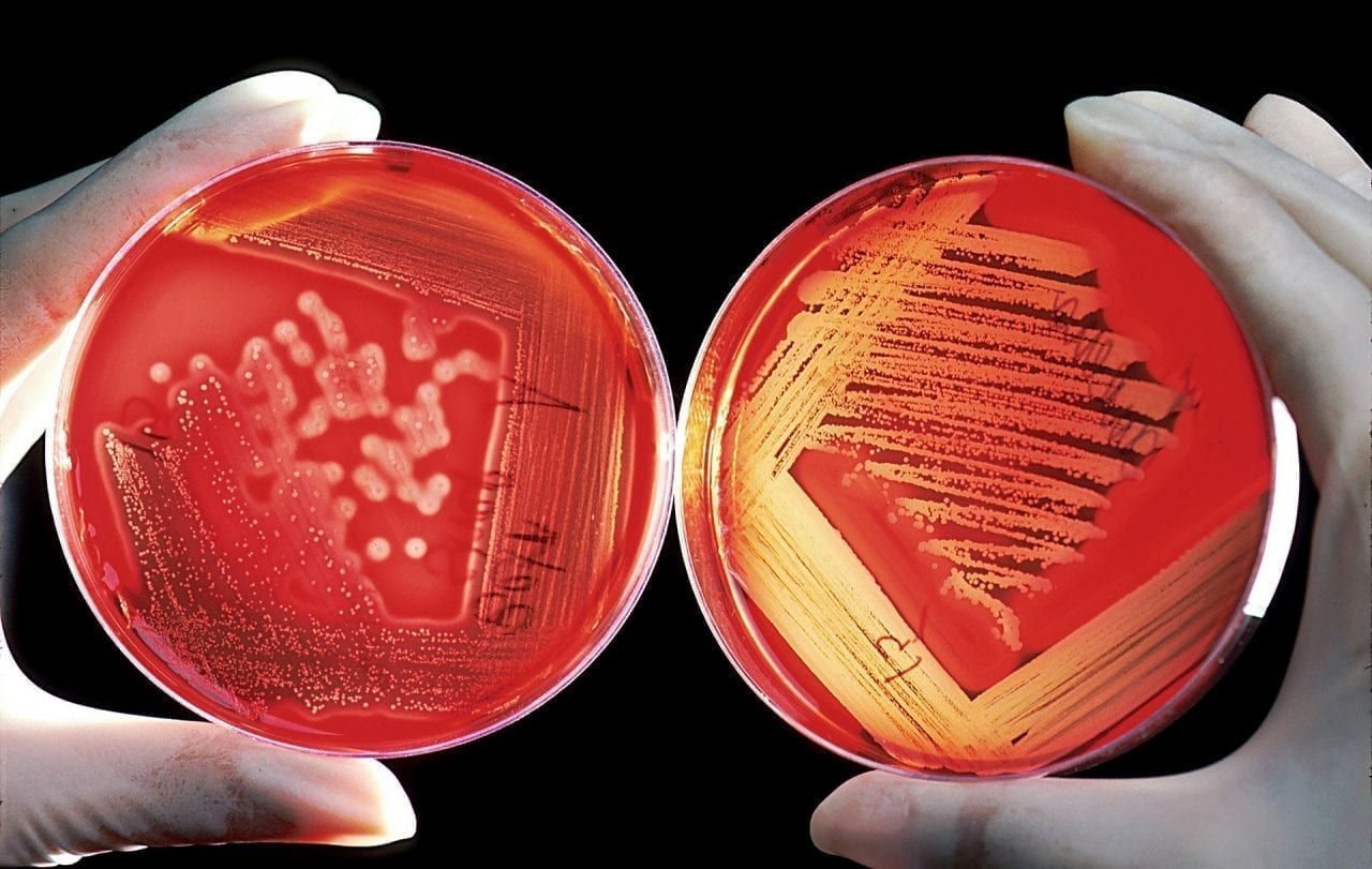 Bakterien und Keime im Labortest